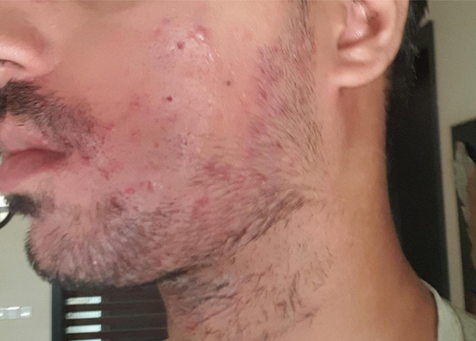 image comparison before